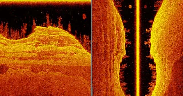 Imagen obtenida con el sistema SideVü (imagen Garmin).